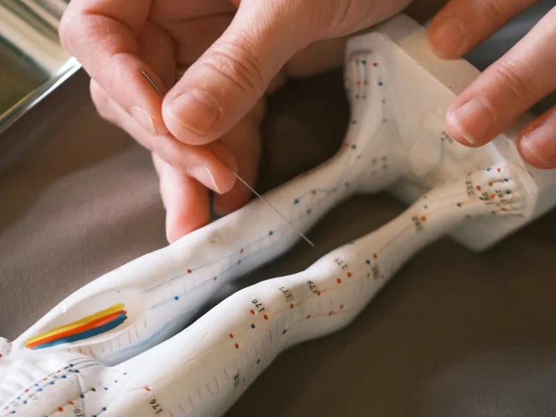 Acupuncture at Melbourne Chiropractic Spine & Injury Center in Palm Bay