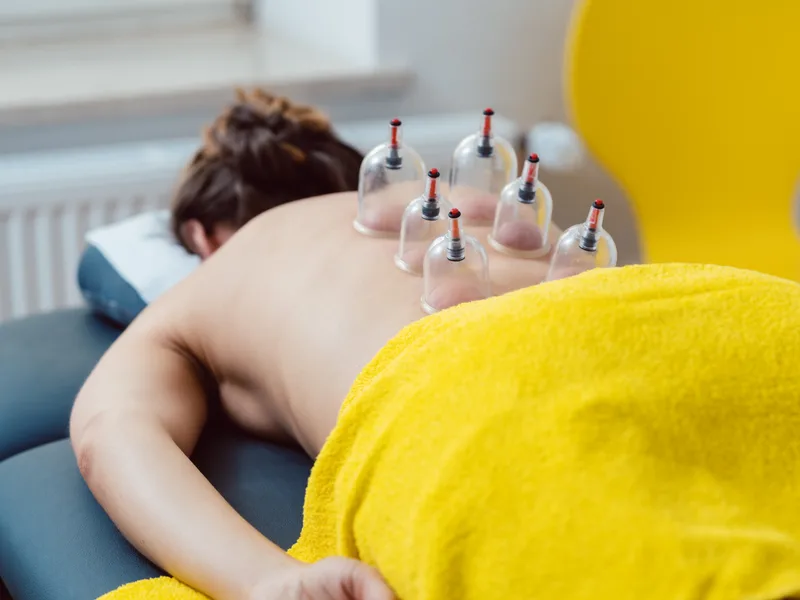 Cupping Therapy at Melbourne Chiropractic Spine & Injury Center in Palm Bay