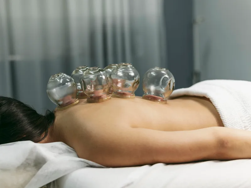 Cupping Therapy at Melbourne Chiropractic Spine & Injury Center in Palm Bay