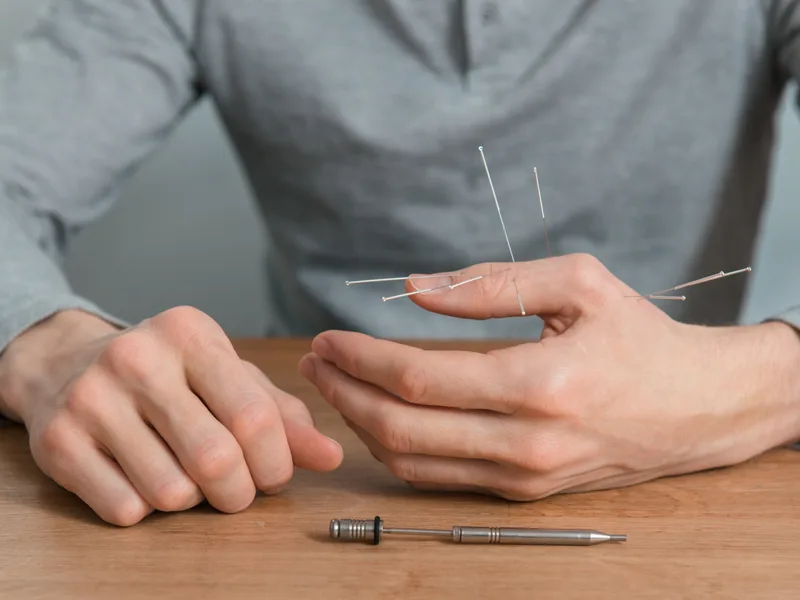 Dry Needling at Melbourne Chiropractic Spine & Injury Center in Palm Bay