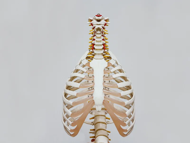 How X-Rays works at Melbourne Chiropractic Spine & Injury Center